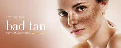 Melasma Treatments: Exploring Beyond Hydroquinone Creams for Hyperpigmentation - M