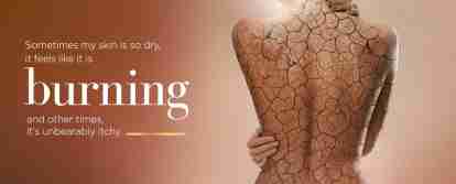 b12 injections for psoriasis Treating Plaque Psoriasis with LDN and B12: Alternative Psoriasis