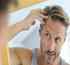 Androgenic Alopecia: What You Need to Know (Part 1) - Thumbnail