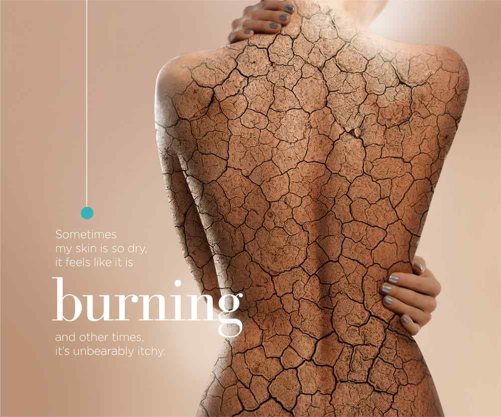 sometimes my skin is so dry it feels like burning and other times it's unbearably itchy