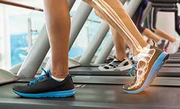 human legs exercising on a treadmill with skeletal being shown on one leg through illustration