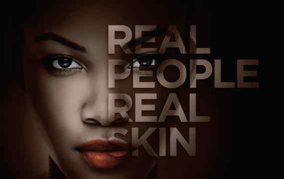 black eyed, beautiful women, real people real skin, dermatology