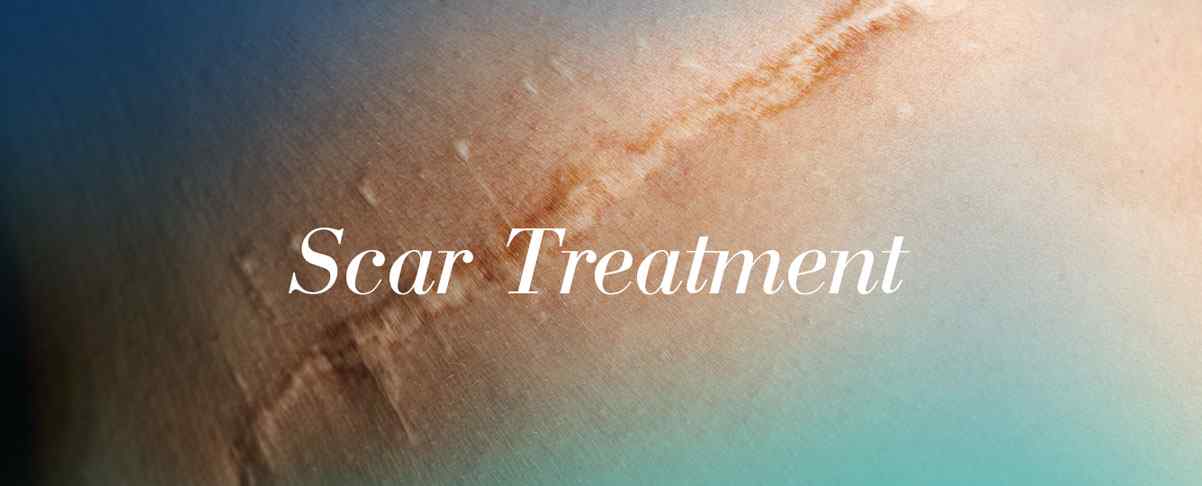 Scar Treatment