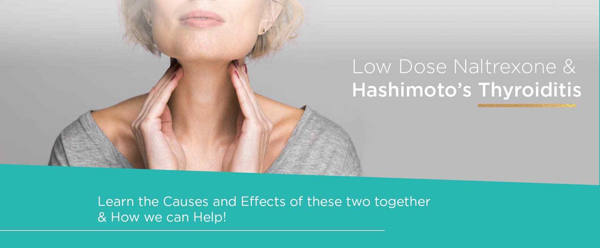 The Interplay between Low Dose Naltrexone and Hashimoto’s Thyroiditis