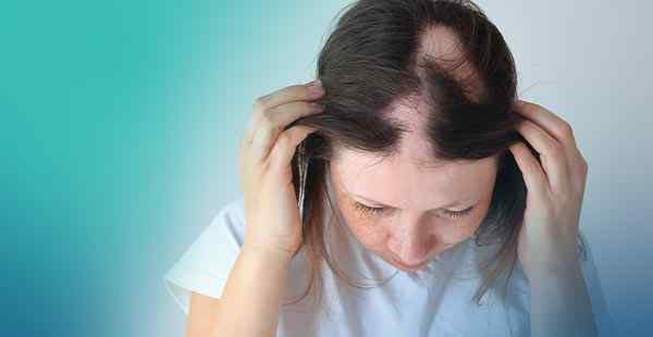 Unconventional Therapies for Alopecia Areata